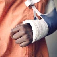 BrokenArm BrokenArm